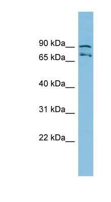 Western Blot: MTRR Antibody [NBP1-57749]