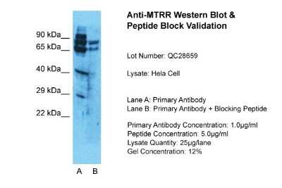 Western Blot: MTRR Antibody [NBP1-57749]