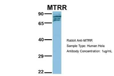 Western Blot: MTRR Antibody [NBP1-57749]