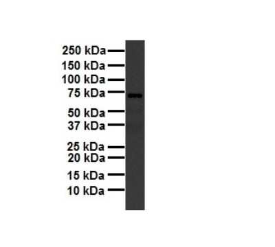 Western Blot: MTRR Antibody [NBP2-87858]