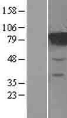 Western Blot: MTRR Overexpression Lysate [NBL1-13385]