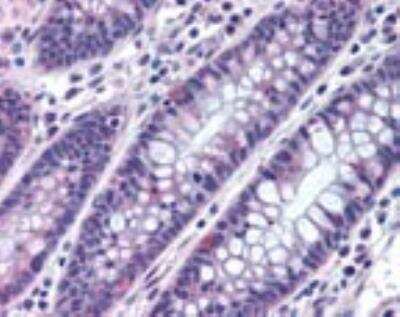 Immunohistochemistry-Paraffin: MTSS1 Antibody [NBP2-24716]