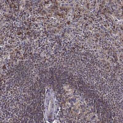 Immunohistochemistry-Paraffin: MTSS1 Antibody [NBP2-58013]