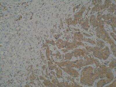 Immunohistochemistry-Paraffin: MTSS1 Antibody (M7P3A7) - BSA Free [NBP2-50518]