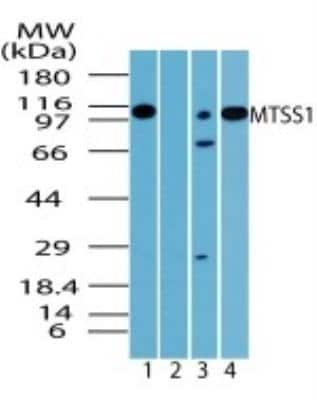 Western Blot: MTSS1 Antibody [NBP2-24716]