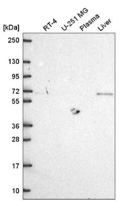 Western Blot: MTSS1 Antibody [NBP2-58013]