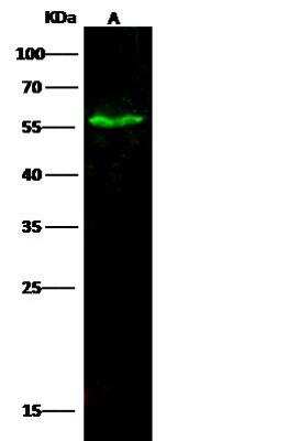 Western Blot: MTSS1 Antibody [NBP3-00067]