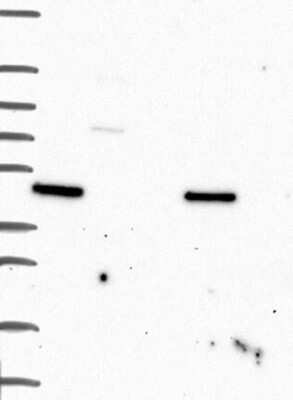 Western Blot: MTSS1 Antibody [NBP3-17673]