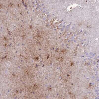 Immunohistochemistry-Paraffin: MTSS1L Antibody [NBP2-14642]