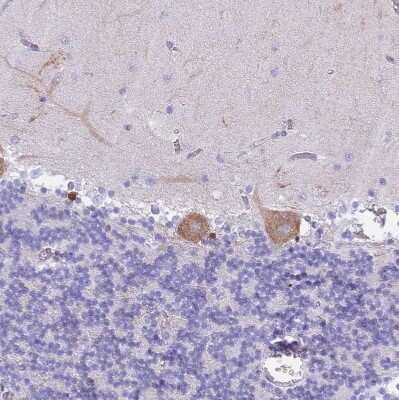 Immunohistochemistry-Paraffin: MTSS1L Antibody [NBP2-14642]