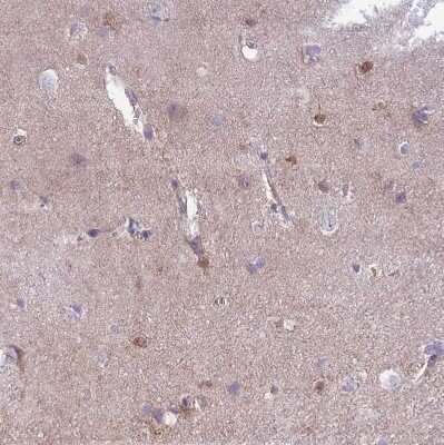 Immunohistochemistry-Paraffin: MTSS1L Antibody [NBP2-14642]