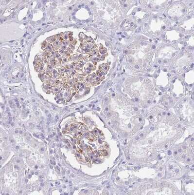 Immunohistochemistry-Paraffin: MTSS1L Antibody [NBP2-14642]