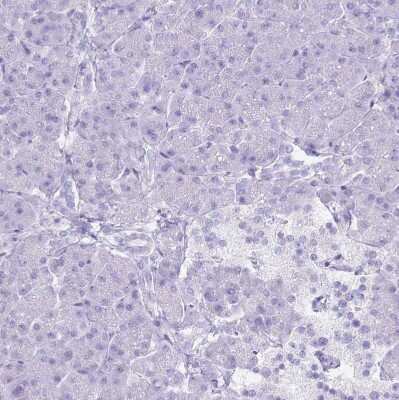 Immunohistochemistry-Paraffin: MTSS1L Antibody [NBP2-14642]