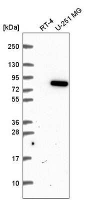 Western Blot: MTSS1L Antibody [NBP2-57037]