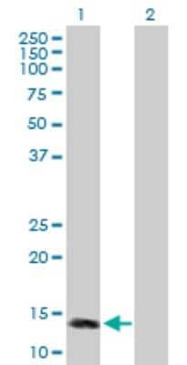 Western Blot: MTTP Antibody [H00004547-B01P]