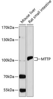 Western Blot: MTTP AntibodyAzide and BSA Free [NBP2-94915]