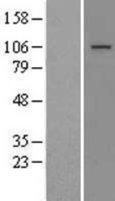 Western Blot: MTTP Overexpression Lysate [NBL1-13387]