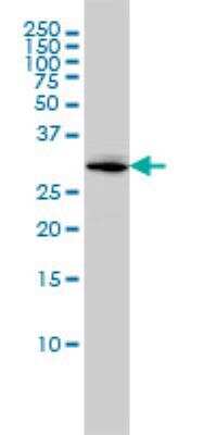 Western Blot: MTUS1 Antibody (1C7) [H00057509-M01]