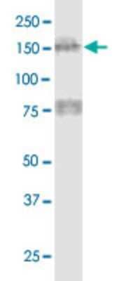 Western Blot: MTUS1 Antibody (1C7) [H00057509-M01]