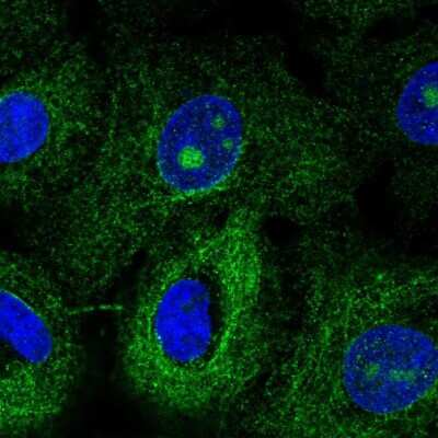 Immunocytochemistry/ Immunofluorescence: MTUS1 Antibody [NBP2-57208]