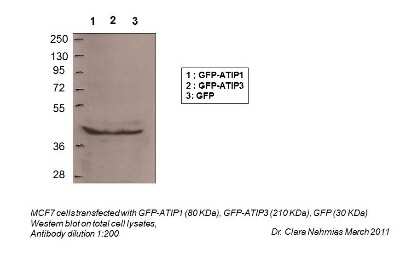 Western Blot: MTUS1 Antibody [NBP1-60097]