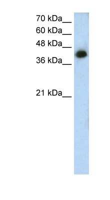 Western Blot: MTUS1 Antibody [NBP1-60097]