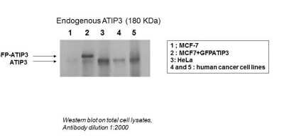 Western Blot: MTUS1 Antibody [NBP1-60099]