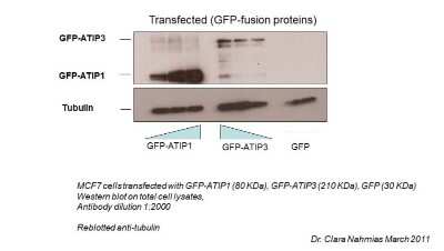 Western Blot: MTUS1 Antibody [NBP1-60099]