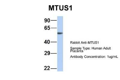 Western Blot: MTUS1 Antibody [NBP1-60099]