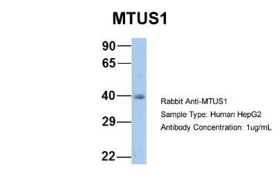 Western Blot: MTUS1 Antibody [NBP1-60099]