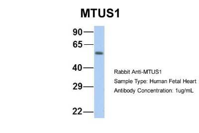 Western Blot: MTUS1 Antibody [NBP1-60099]
