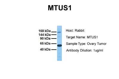 Western Blot: MTUS1 Antibody [NBP1-60099]