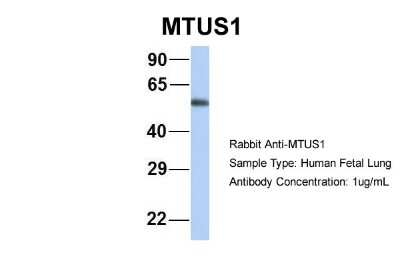 Western Blot: MTUS1 Antibody [NBP1-60099]