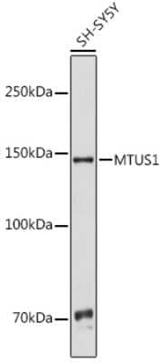 Western Blot: MTUS1 AntibodyBSA Free [NBP3-15462]