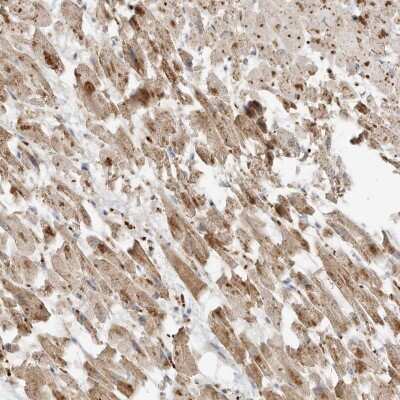 Immunohistochemistry-Paraffin: MTUS2 Antibody [NBP2-54923]