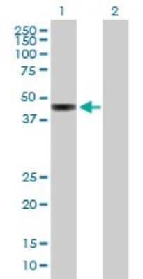 Western Blot: MTUS2 Antibody [H00023281-B01P]