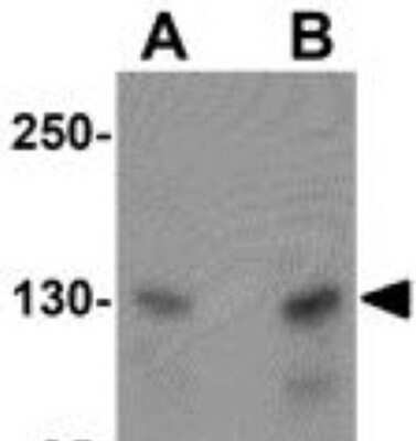 Western Blot: MTUS2 AntibodyBSA Free [NBP1-77130]