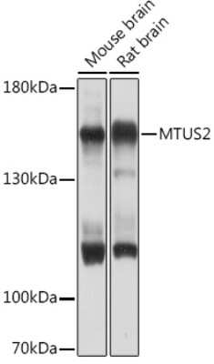 Western Blot: MTUS2 AntibodyAzide and BSA Free [NBP3-15522]