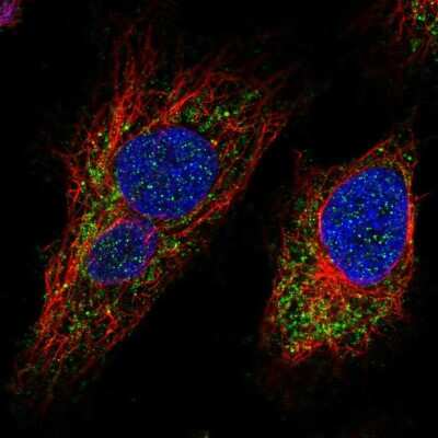 Immunocytochemistry/ Immunofluorescence: MTX3 Antibody [NBP2-57083]