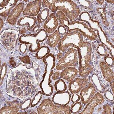 Immunohistochemistry-Paraffin: MTX3 Antibody [NBP2-14620]