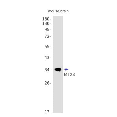 Western Blot: MTX3 Antibody (S08-2K4) [NBP3-19703]