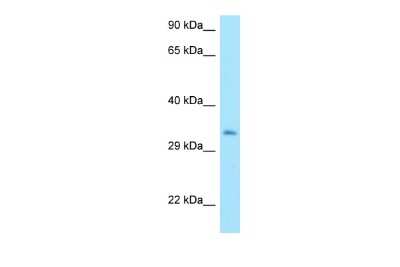 Western Blot: MTX3 Antibody [NBP2-85335]