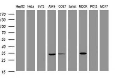 Western Blot: MUC1 Antibody (OTI2E3) [NBP2-45838]