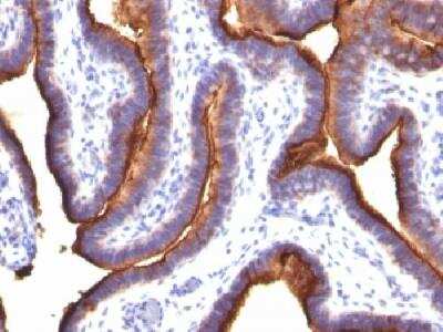 Immunohistochemistry-Paraffin: MUC1 Antibody (MUC1/845) - Azide and BSA Free [NBP2-47881]