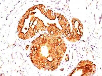 Immunohistochemistry-Paraffin: MUC1 Antibody (MUC1/845) - Azide and BSA Free [NBP2-47881]
