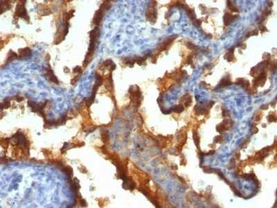Immunohistochemistry-Paraffin: MUC1 Antibody (139H2) - Azide and BSA Free [NBP2-47888]