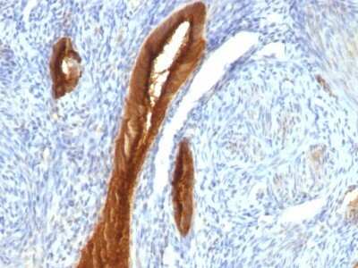 Immunohistochemistry-Paraffin: MUC1 Antibody (139H2) [NBP2-44666]