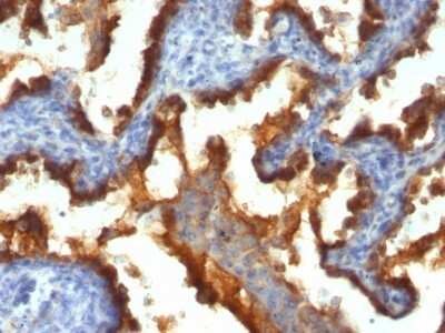 Immunohistochemistry-Paraffin: MUC1 Antibody (139H2) [NBP2-44666]