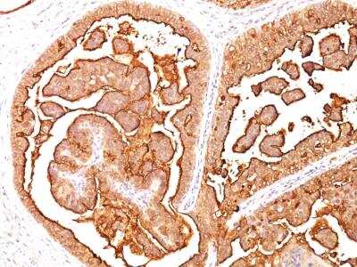 Immunohistochemistry-Paraffin: MUC1 Antibody (E29) - IHC-Prediluted [NBP2-48376]