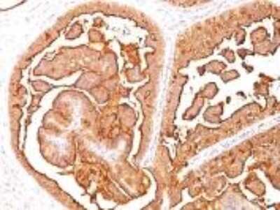 Immunohistochemistry-Paraffin: MUC1 Antibody (E29) [NBP2-44663]